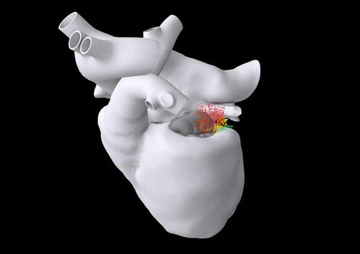 foto Dassault Systèmes impulsa la nueva fase del Proyecto Living Heart con gemelos virtuales basados en IA.